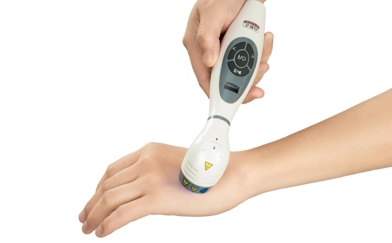 Precautions for Patients with Vitiligo When Using 308nm Light Therapy at Home